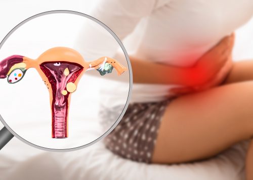 Endometriosis, virtual model of the uterus, close-up. Woman suffering from menstrual pain, while sitting on bed. Stomach pain